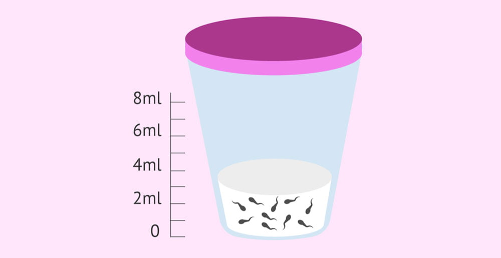 Semen Specimen Cup